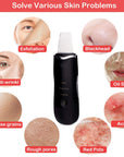 Rechargeable Ultrasonic Skin Scrubber — alternate product view 7