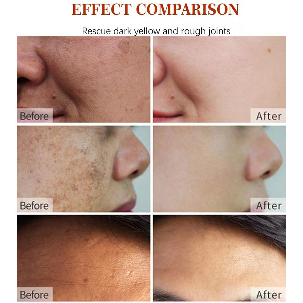 Korean Glass Skin Essentials – Vitamin C, Collagen, Retinol, Hyaluronic Acid & Dark Spot Correctors for Flawless Radiance