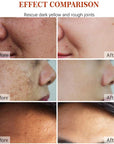 Korean Glass Skin Essentials – Vitamin C, Collagen, Retinol, Hyaluronic Acid & Dark Spot Correctors for Flawless Radiance
