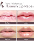 DEROL™ Lip Plumper Kit