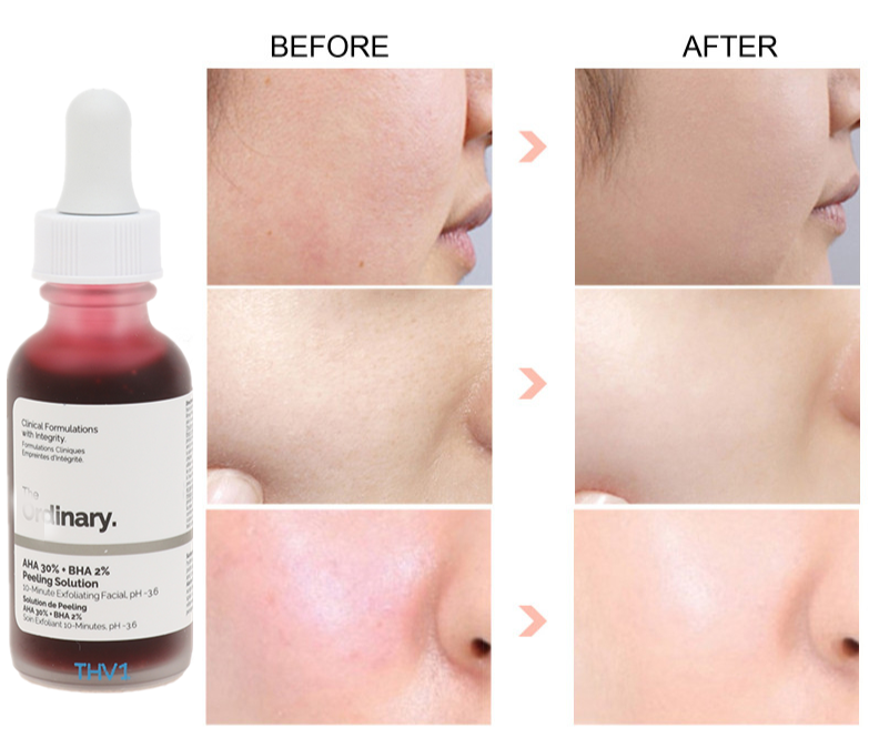 Ordinary Peeling Solution AHA 30% + BHA 2%