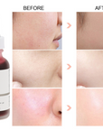Ordinary Peeling Solution AHA 30% + BHA 2%