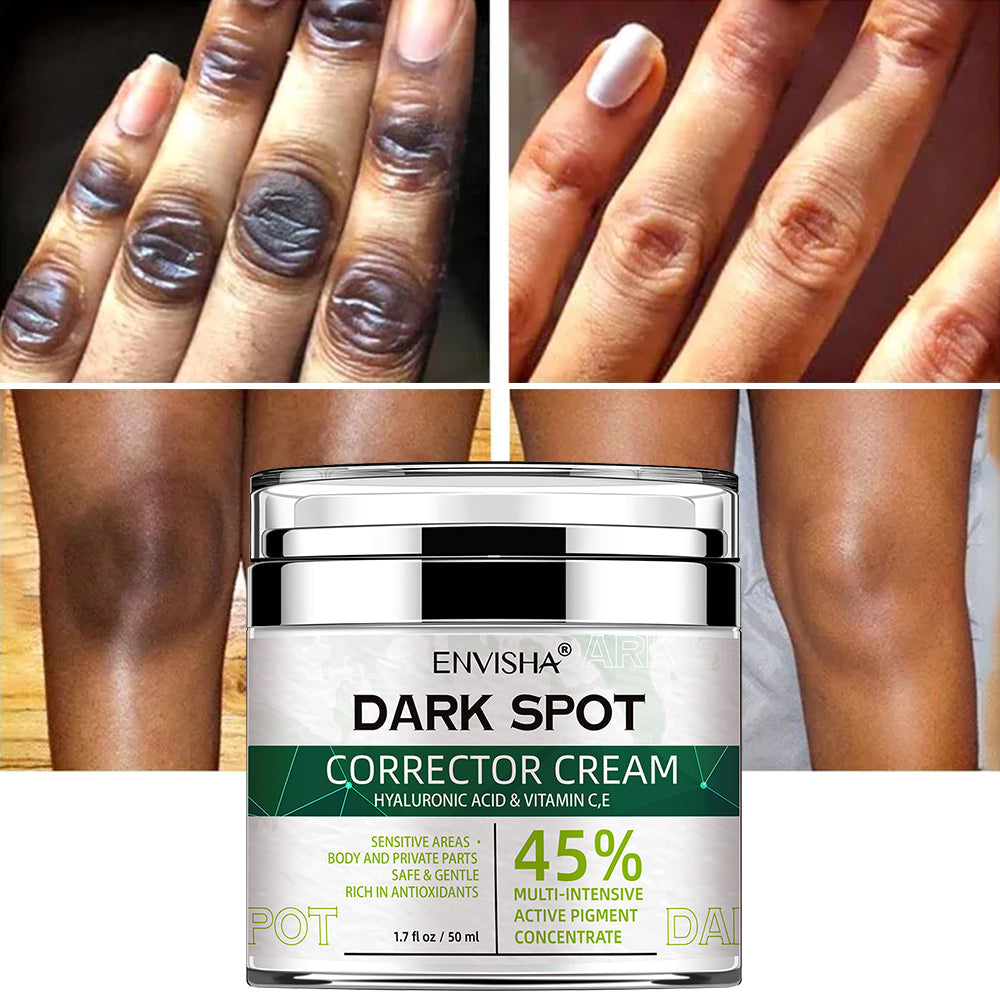 korean dark spot corrector cream