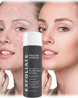 Paula's Choice Facial Exfoliant