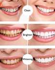 Teeth Whitening Pen