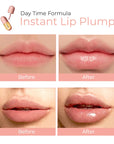 DEROL™ Lip Plumper Kit